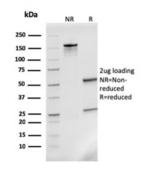 Monocyte Chemotactic Protein 2 (MCP2) / CCL8 Antibody