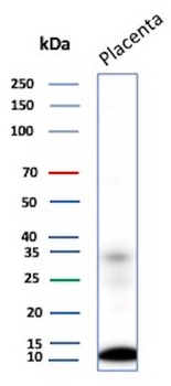 Monocyte Chemotactic Protein 2 (MCP2) / CCL8 Antibody