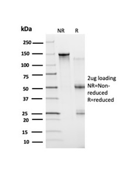 BCL6 Antibody