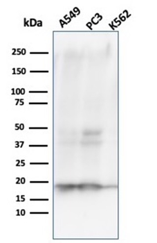 Nucleoside Diphosphate Kinase A / nm23-H1 Antibody