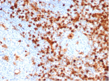 Recombinant Annexin A1 / (Hairy Cell Leukemia Marker) Antibody