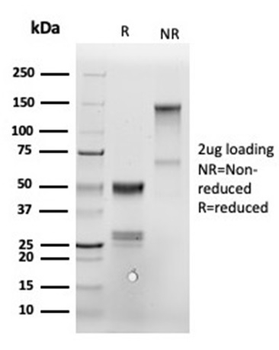 Recombinant Annexin A1 / (Hairy Cell Leukemia Marker) Antibody