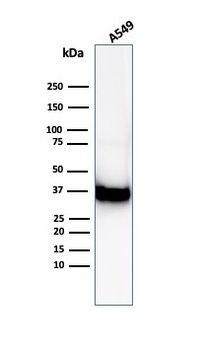Recombinant Annexin A1 / (Hairy Cell Leukemia Marker) Antibody