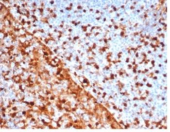 Recombinant Annexin A1 / (Hairy Cell Leukemia Marker) Antibody