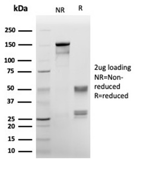 Recombinant Annexin A1 / (Hairy Cell Leukemia Marker) Antibody