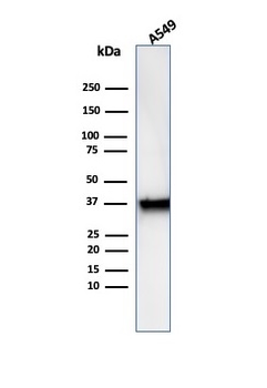 Recombinant Annexin A1 / (Hairy Cell Leukemia Marker) Antibody