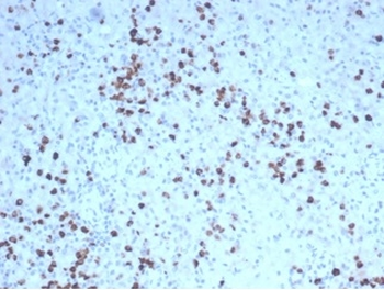 Recombinant Granzyme B (NK/T-Cell Lymphoma Marker) Antibody