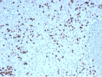 Recombinant Granzyme B (NK/T-Cell Lymphoma Marker) Antibody