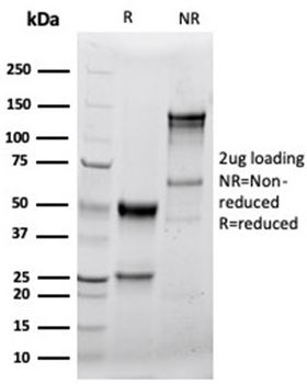 Recombinant Granzyme B (NK/T-Cell Lymphoma Marker) Antibody