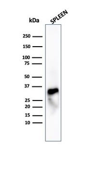 Recombinant Granzyme B (NK/T-Cell Lymphoma Marker) Antibody
