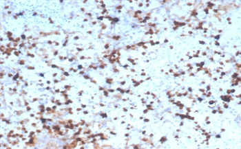 Recombinant Granzyme B (NK/T-Cell Lymphoma Marker) Antibody