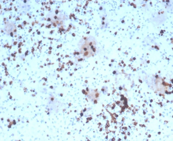 Recombinant Granzyme B (NK/T-Cell Lymphoma Marker) Antibody