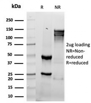 Recombinant Granzyme B (NK/T-Cell Lymphoma Marker) Antibody