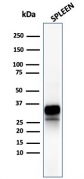 Recombinant Granzyme B (NK/T-Cell Lymphoma Marker) Antibody