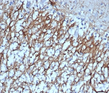 GFAP (Astrocyte & Neural Stem Cell Marker) Antibody