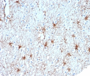 GFAP (Astrocyte & Neural Stem Cell Marker) Antibody