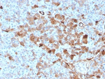 GC Vitamin D Binding Protein Antibody