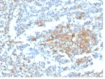GC Vitamin D Binding Protein Antibody