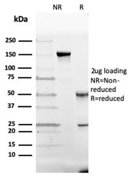 GC Vitamin D Binding Protein Antibody