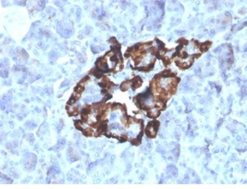 GC Vitamin D Binding Protein Antibody