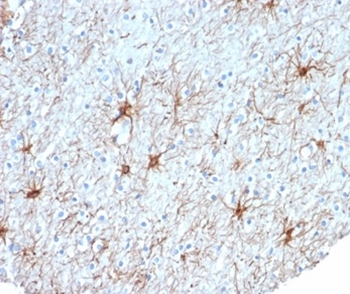 GFAP (Astrocyte & Neural Stem Cell Marker) Antibody