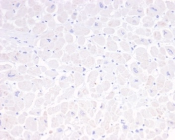 GFAP (Astrocyte & Neural Stem Cell Marker) Antibody