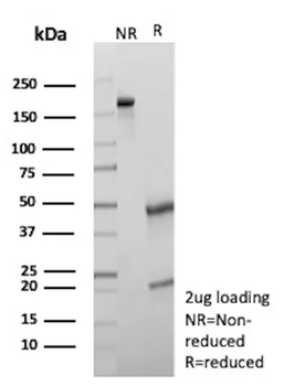 GFAP (Astrocyte & Neural Stem Cell Marker) Antibody