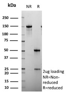 Recombinant SATB2 (Colorectal Carcinoma Marker) Antibody