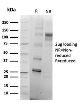 Recombinant SATB2 (Colorectal Carcinoma Marker) Antibody