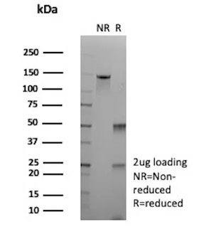 Recombinant ALDH1A1 (Aldehyde Dehydrogenase 1A1) Antibody