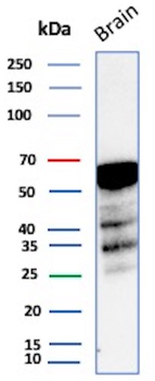 Recombinant ALDH1A1 (Aldehyde Dehydrogenase 1A1) Antibody