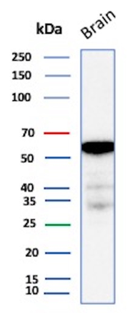 Recombinant ALDH1A1 (Aldehyde Dehydrogenase 1A1) Antibody
