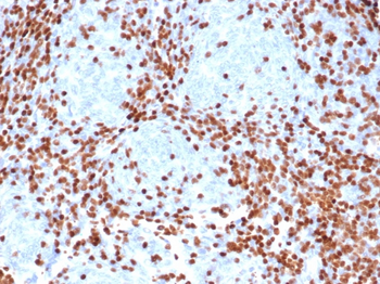 Recombinant TdT / DNA Nucleotidylexotransferase (Acute Lymphoblastic Leukemia Marker) Antibody