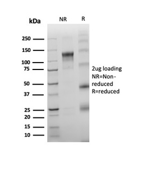 Recombinant TdT / DNA Nucleotidylexotransferase (Acute Lymphoblastic Leukemia Marker) Antibody