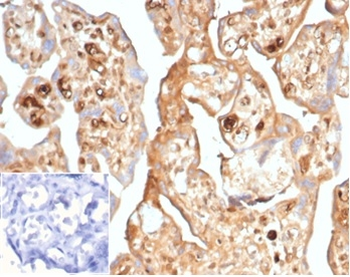 AFP Antibody