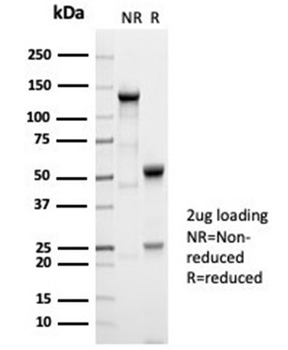 AFP Antibody
