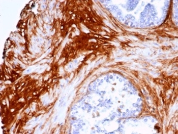 DCN Antibody