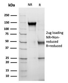 Alpha-1-Antichymotrypsin (SERPINA3) (Histiocytoma Marker) Antibody