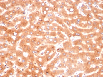 Alpha-1-Antichymotrypsin (SERPINA3) (Histiocytoma Marker) Antibody