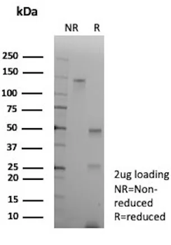 Alpha-1-Antichymotrypsin (SERPINA3) (Histiocytoma Marker) Antibody