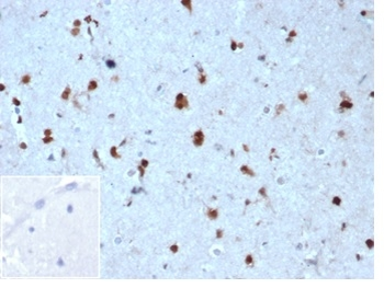 p27Kip1 (Mitotic Inhibitor/Suppressor Protein) Antibody