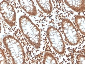 p27Kip1 (Mitotic Inhibitor/Suppressor Protein) Antibody