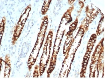 Recombinant Ksp-Cadherin (Kidney-Specific Cadherin) / CDH16 Antibody