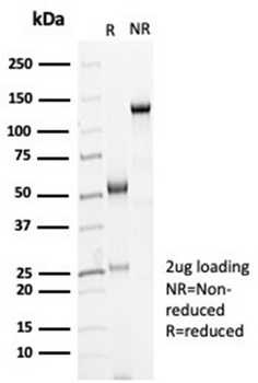 Recombinant Ksp-Cadherin (Kidney-Specific Cadherin) / CDH16 Antibody