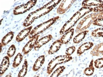 Recombinant Ksp-Cadherin (Kidney-Specific Cadherin) / CDH16 Antibody
