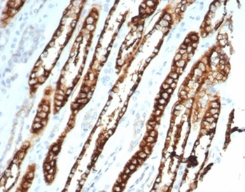 Recombinant Ksp-Cadherin (Kidney-Specific Cadherin) / CDH16 Antibody