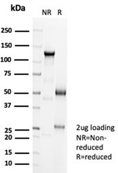 Recombinant Ksp-Cadherin (Kidney-Specific Cadherin) / CDH16 Antibody