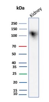 Recombinant Ksp-Cadherin (Kidney-Specific Cadherin) / CDH16 Antibody