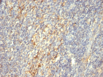 TGM2 Antibody