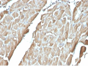 Heart Fatty Acid Binding Protein (H-FABP) / FABP3 Antibody